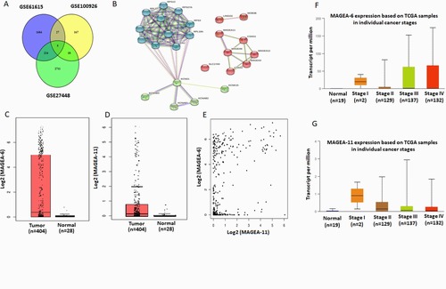 Co‑expression of cancer‑testis antigens of MAGE‑A6 and MAGE‑A11 is associated with tumor aggressiveness in patients with bladder cancer